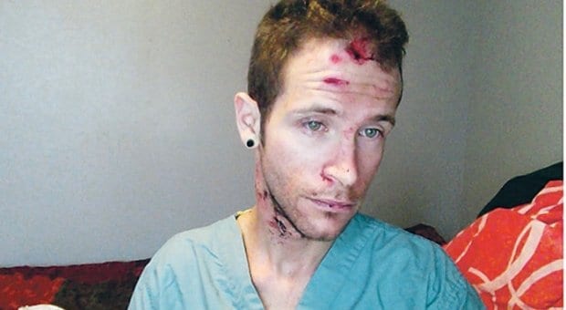 A reporter reacts to possibly being duped by an alleged gaybashing victim
