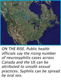 Neurosyphilis cases up across Canada and US
