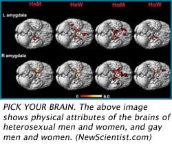 Gay brains similar to opposite-sex straight brains