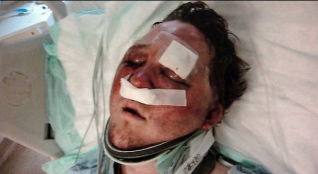 Gay North Texas man beaten after meeting teen through app