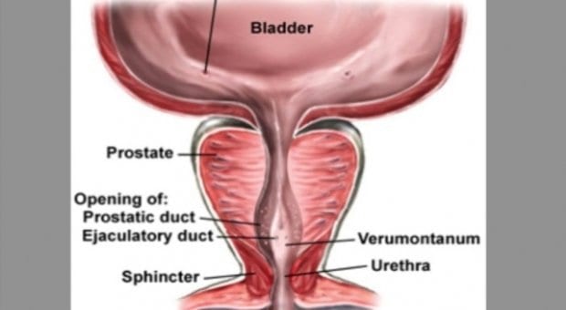 Sex after prostate surgery