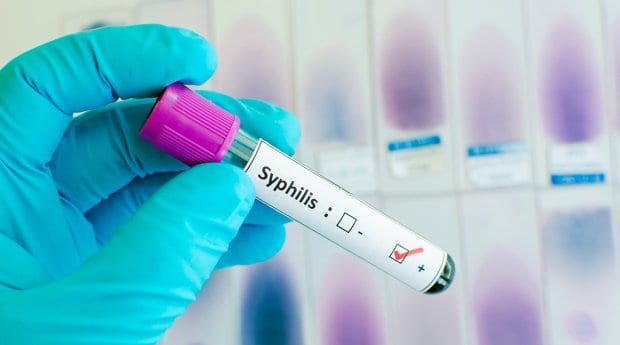 Syphilis on the rise in gay men