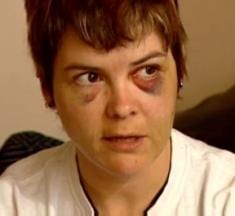 Attack against Edmonton lesbian not investigated by police until five days later