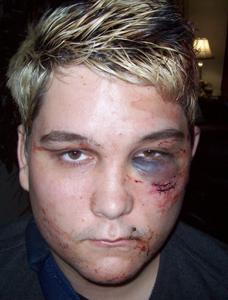 Is gaybashing on the rise?