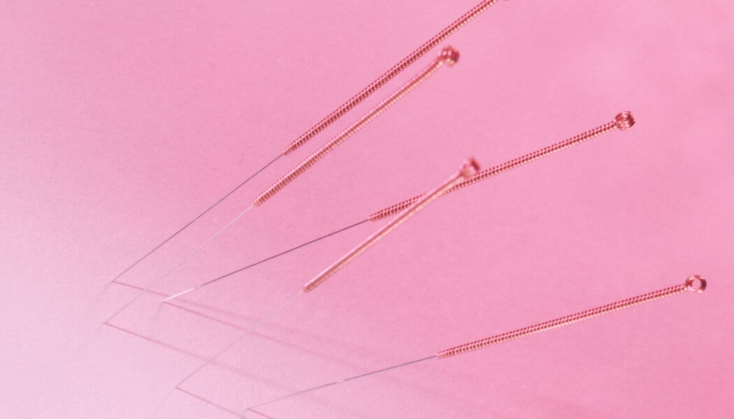 What people with uteruses should know about acupuncture and fertility