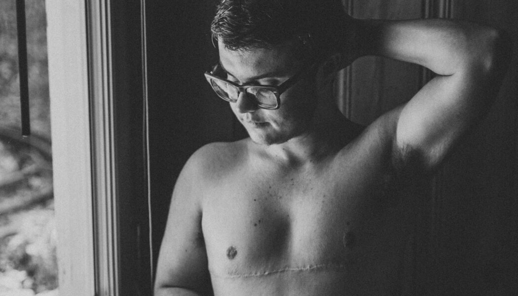 A trans man modelled nude for 150 photographers, and fell in love with his body