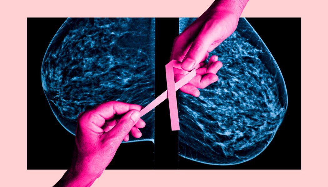 Trans people need breast cancer screenings—but they struggle to get them