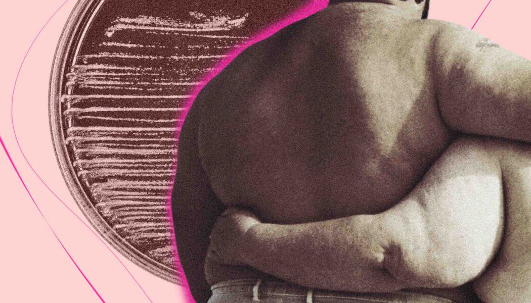 Bud scars and bodies in queer middle age 